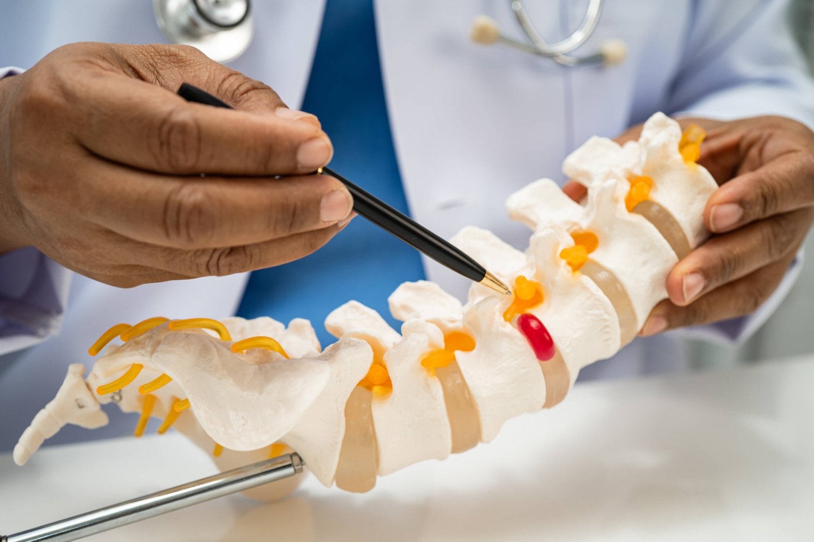 Supplying affordable implants